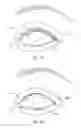 Fig. 12 - Controller for dry eye treatment systems