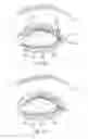 Fig. 14 - Controller for dry eye treatment systems