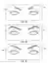 Fig. 16 - Controller for dry eye treatment systems
