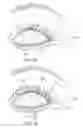 Fig. 18 - Controller for dry eye treatment systems