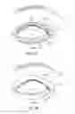 Fig. 21 - Controller for dry eye treatment systems