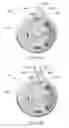 Fig. 24 - Controller for dry eye treatment systems