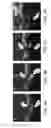 Fig. 03 - Image-guided delivery of ophthalmic therapeutics