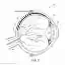 Fig. 03 - OCULAR GELS OR HYDROGELS AND MICROINJECTORS