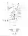Fig. 05 - Laser eye surgery lens fragmentation
