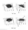 Fig. 20 - Laser eye surgery lens fragmentation