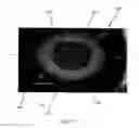 Fig. 25 - Laser eye surgery lens fragmentation