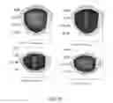 Fig. 28 - Laser eye surgery lens fragmentation