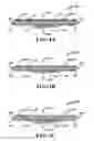 Fig. 03 - ADHESIVE BANDAGE WITH A GLITTERED OUTER SURFACE