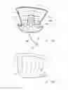 Fig. 12 - Female incontinence system