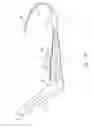 Fig. 15 - Female incontinence system
