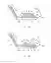 Fig. 18 - Female incontinence system