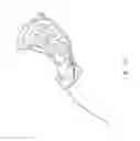Fig. 23 - Female incontinence system