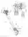 Fig. 05 - Multi-axis joint for a spar of a limb holder