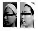 Fig. 03 - Pharmaceutical Composition for Treating Scars on the Skin, and Method for Treating Scars on the Skin Using Same