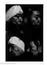 Fig. 04 - Pharmaceutical Composition for Treating Scars on the Skin, and Method for Treating Scars on the Skin Using Same