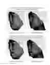 Fig. 05 - Pharmaceutical Composition for Treating Scars on the Skin, and Method for Treating Scars on the Skin Using Same