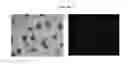 Fig. 02 - METHOD FOR THE PREPARATION OF DEGRADABLE MICROGEL PARTICLES, AND MICROGEL COMPOSITIONS THEREOF