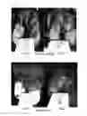 Fig. 02 - Method for preventing and/or treating hairy wart disease
