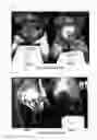 Fig. 03 - Method for preventing and/or treating hairy wart disease
