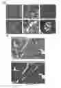 Fig. 03 - THERAPIES FOR CARDIOMYOPATHY