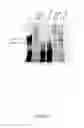 Fig. 17 - CFTR mRNA compositions and related methods and uses