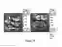 Fig. 26 - CFTR mRNA compositions and related methods and uses