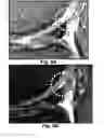 Fig. 13 - Methods and compositions for optimized expansion and implantation of mesenchymal stem cells