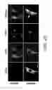 Fig. 10 - HIGH TELOMERASE ACTIVITY BONE MARROW MESENCHYMAL STEM CELLS, METHODS OF PRODUCING THE SAME AND PHARMACEUTICALS AND TREATMENT METHODS BASED THEREON