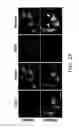 Fig. 11 - HIGH TELOMERASE ACTIVITY BONE MARROW MESENCHYMAL STEM CELLS, METHODS OF PRODUCING THE SAME AND PHARMACEUTICALS AND TREATMENT METHODS BASED THEREON