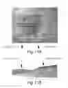 Fig. 16 - Wound healing and tissue engineering
