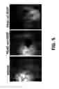 Fig. 06 - ANGIOGENESIS USING PLACENTAL STEM CELLS