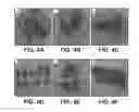 Fig. 06 - UMBILICAL CORD PRODUCTS