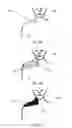 Fig. 03 - TOPICAL TREATMENT OF SHINGLES