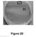 Fig. 10 - Method of treatment