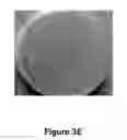 Fig. 11 - Method of treatment