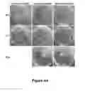 Fig. 12 - Method of treatment