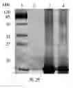 Fig. 10 - Human coagulation factor light chain protein and use of the same