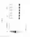 Fig. 04 - Yeast-brachyury immunotherapeutic compositions