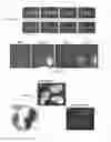 Fig. 08 - Groundbreaking Platform Technology for Specific Binding to Necrotic Cells