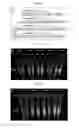 Fig. 09 - Targeting of pharmaceutical agents to pathologic areas using bifunctional fusion polypeptides