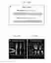 Fig. 12 - Targeting of pharmaceutical agents to pathologic areas using bifunctional fusion polypeptides