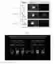 Fig. 13 - Targeting of pharmaceutical agents to pathologic areas using bifunctional fusion polypeptides
