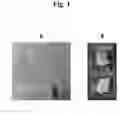 Fig. 02 - Biocompatible fiducial marker using multi-block copolymers