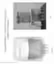 Fig. 08 - NOVEL CHAMBER FOR THE COLLECTION OF LIPOASPIRATE