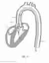 Fig. 26 - Catheter device