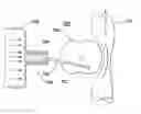 Fig. 01 - System for producing continuous mechanical energy to treat heart failure without the use of external energy source