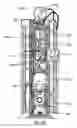 Fig. 18 - Insulin pump data acquisition device and system