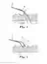 Fig. 05 - DRUG DELIVERY DEVICE