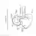 Fig. 04 - Adjustable medium diverter